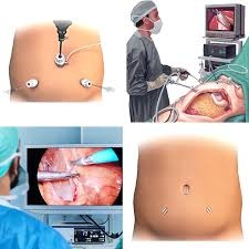 Laparoscopic Surgery Specialist in Nagpur