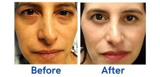 Oculoplastic Eye Surgery Specialist in Nagpur