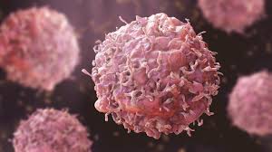 Best Cancer Surgery in Chhindwara