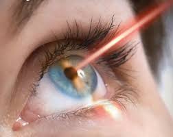 Best Eye Surgery Specialist Doctor in Chhindwara