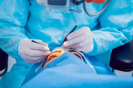 Best Eye Surgery Specialist Doctor in Khandwa