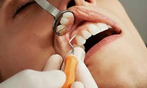 Best Oral Cancer Hospital in Vidisha
