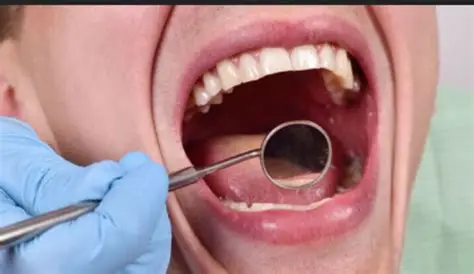 Best Oral Cancer Hospital in amravati