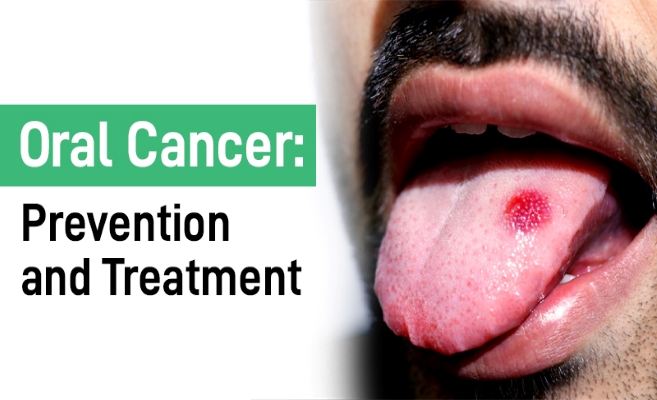 Best oral cancer hospital in gadchiroli