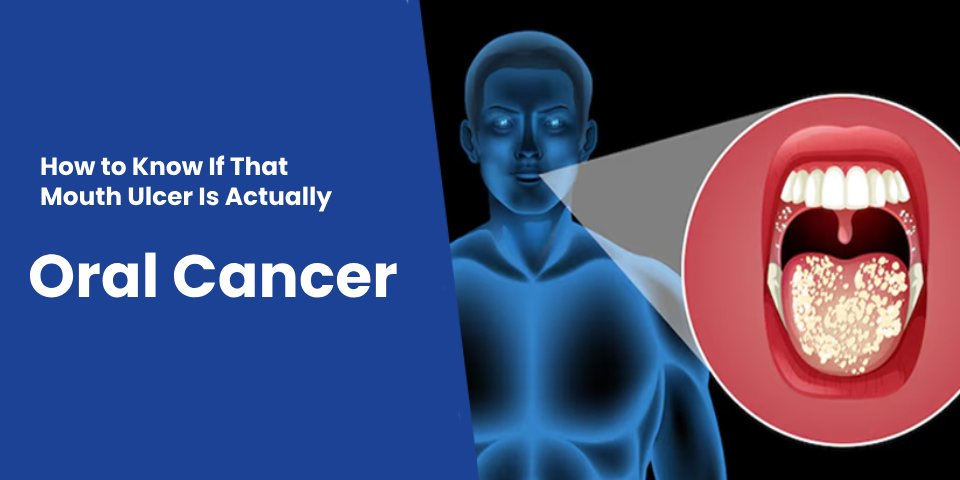 Best oral cancer hospital in sagar