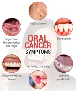 Best oral cancer hospital in washim