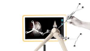 Joint Replacement Surgery Specialist in Chhindwara