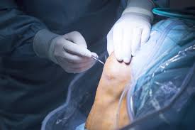 Joint Replacement Surgery Specialist in Jabalpur