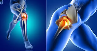 Joint Replacement Surgery Specialist in Wardha