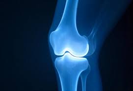 Joint Replacement Surgery Specialist in Yavatmal