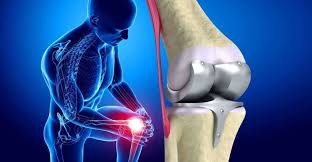 Knee Replacement Dewas