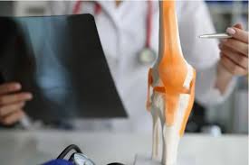 Knee Replacement Jabalpur