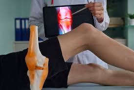 Knee Replacement Khandwa