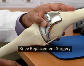 Knee replacement surgery in gadchiroli