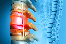 Neuro & Spine Surgery Specialist Hospital in Guna