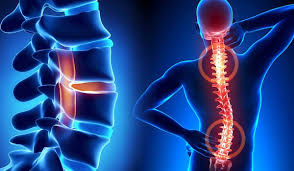 Neuro & Spine Surgery Specialist Hospital in Jabalpur