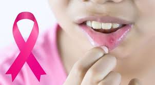 Oral Cancer Specialist Indore​