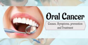 Oral cancer hospital in gwalior