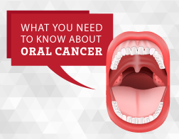 Oral cancer specialist sagar