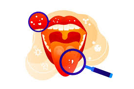 Best Oral Cancer Hospital in Bilaspur