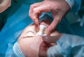 Best Plastic Surgery Specialist Doctor in Bhilai