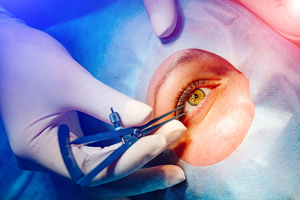 Best eye surgery specialist doctor in hoshangabad
