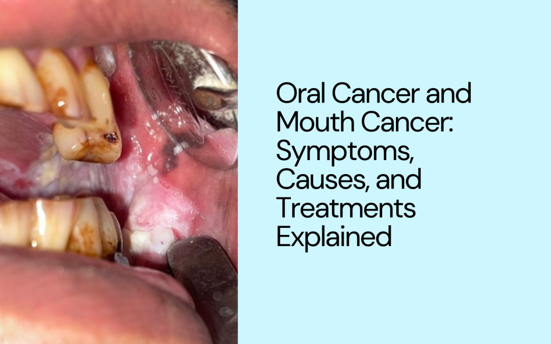 Best oral cancer specialist in balaghat
