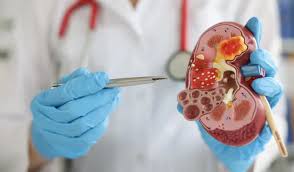 Gastro & Kidney Care Specialist Hospital in Balaghat