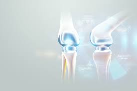 Joint Replacement Surgery Specialist in Bhilai
