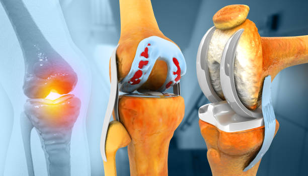 Joint replacement surgery specialist in mandla