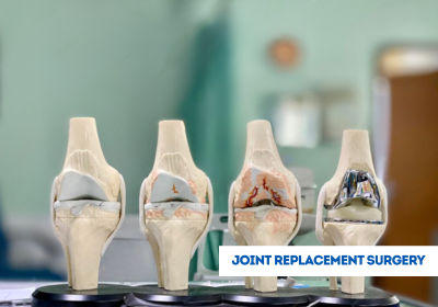 Joint replacement surgery specialist in sheopur