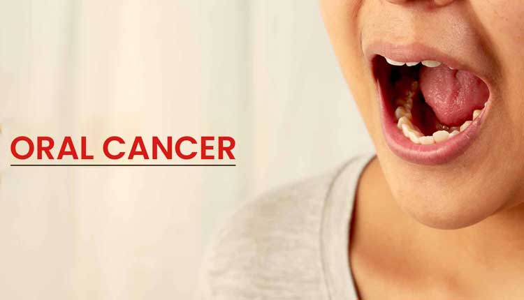 Oral cancer specialist hoshangabad