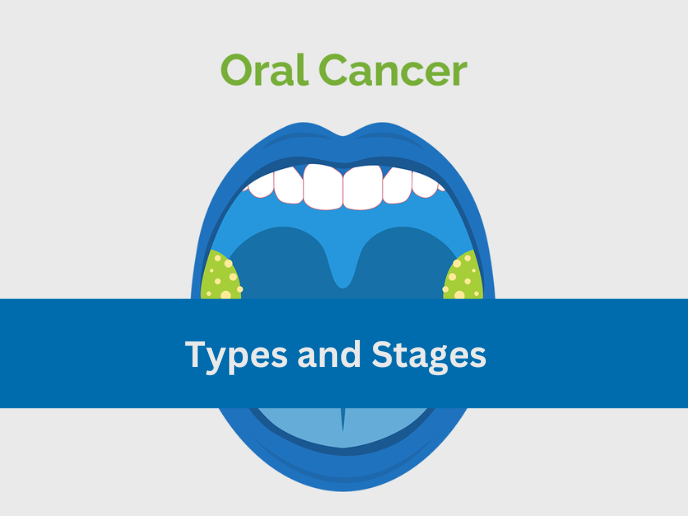 Oral cancer specialist in mandla