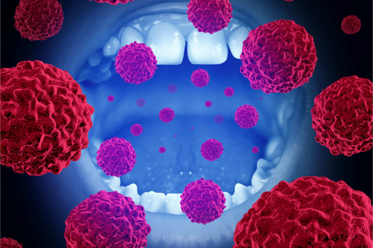 Oral cancer specialist itarsi