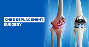 knee replacement in Bhilai