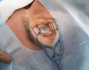 Best eye surgery specialist doctor in dhamtari