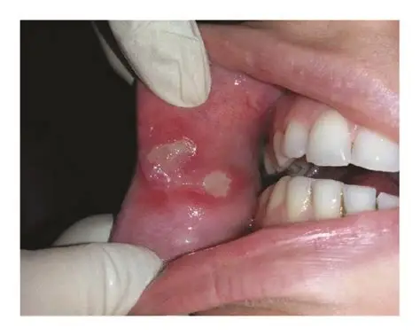 Best oral cancer surgery specialist in jagdalpur
