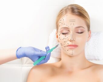 Best plastic surgery specialist doctor in raigarh