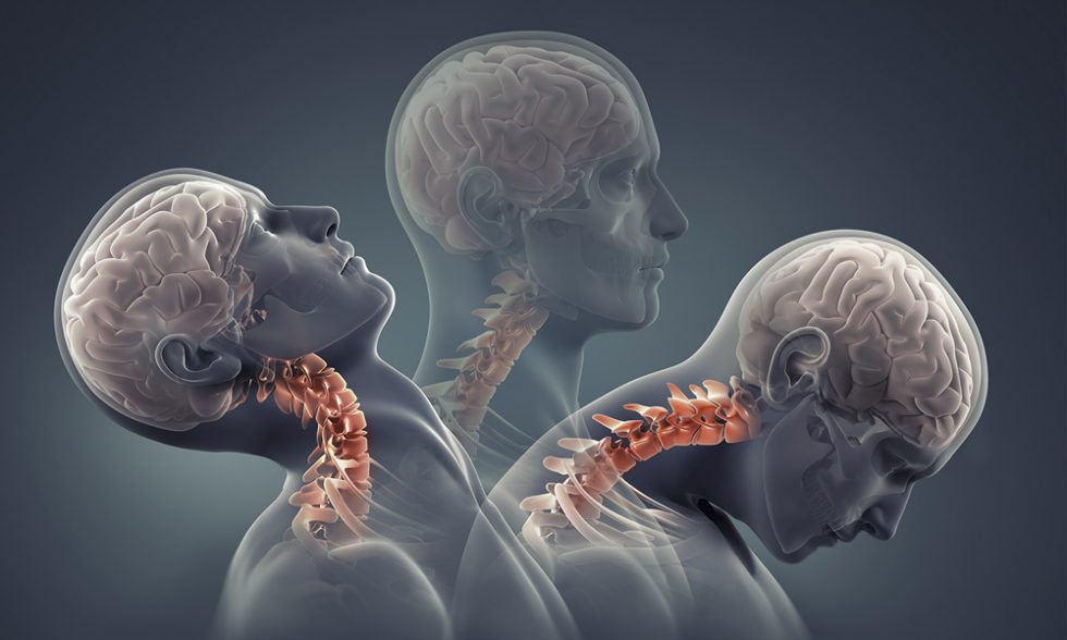 Brain spine hospital in rajnandgaon