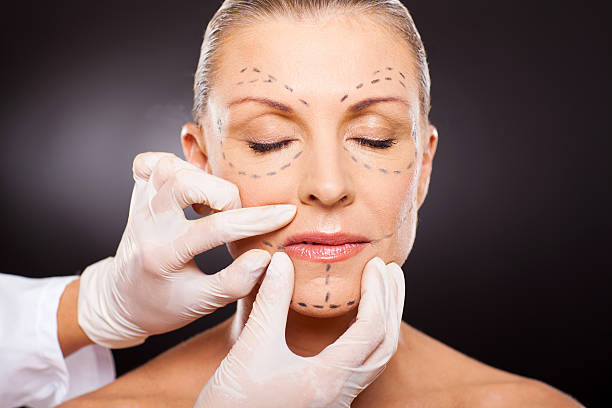 Cosmetic surgeon in kanker