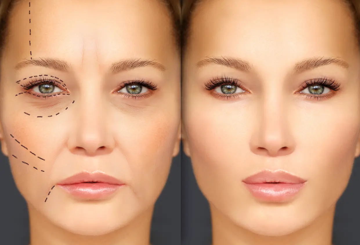 Cosmetic surgeon in surajpur