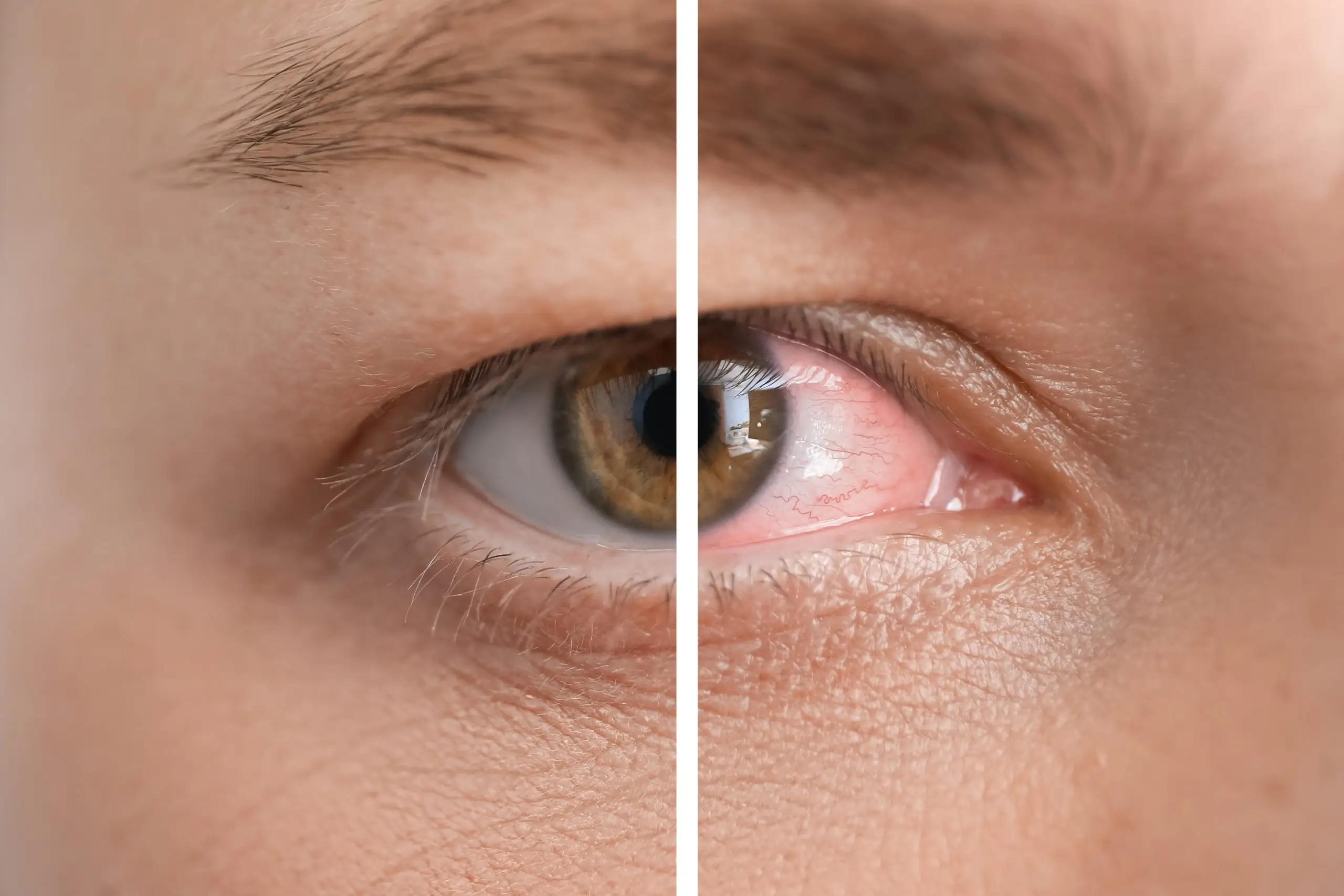 Eye hospital in kondagaon