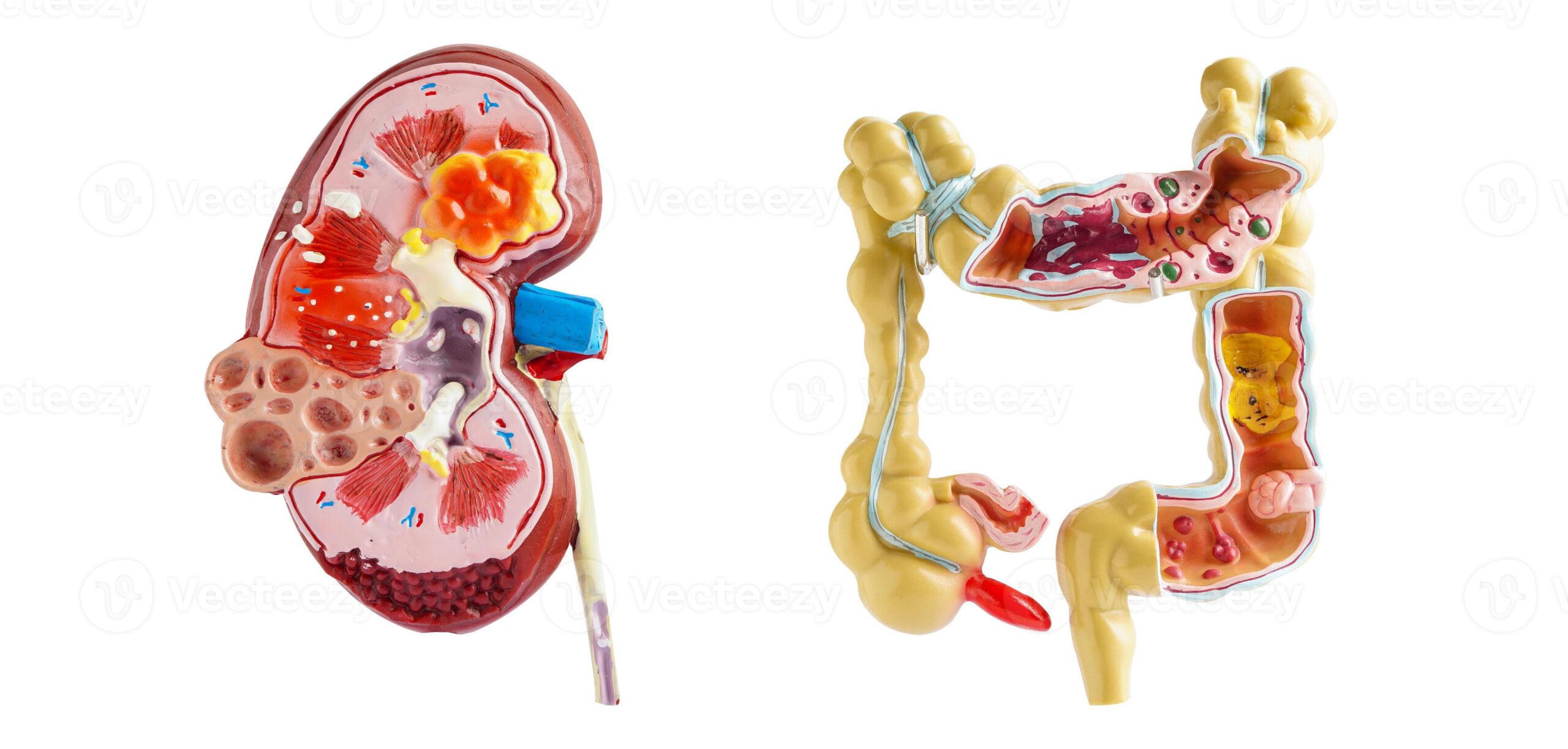Gastro & kidney care specialist hospital in jagdalpur