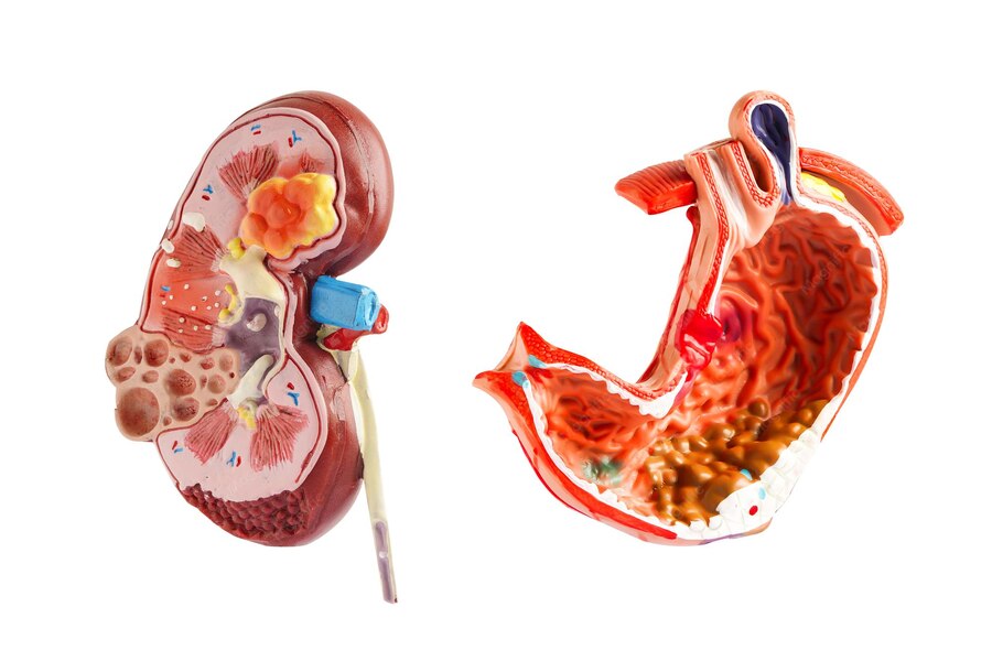 Gastro & kidney care specialist hospital in korba