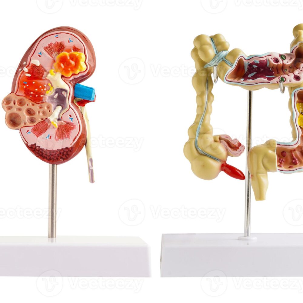 Gastro & kidney care specialist hospital in surajpur