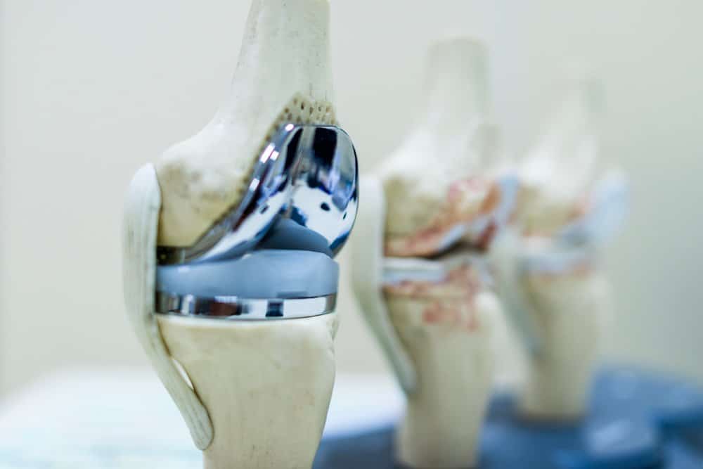 Joint replacement surgery specialist in bijapur