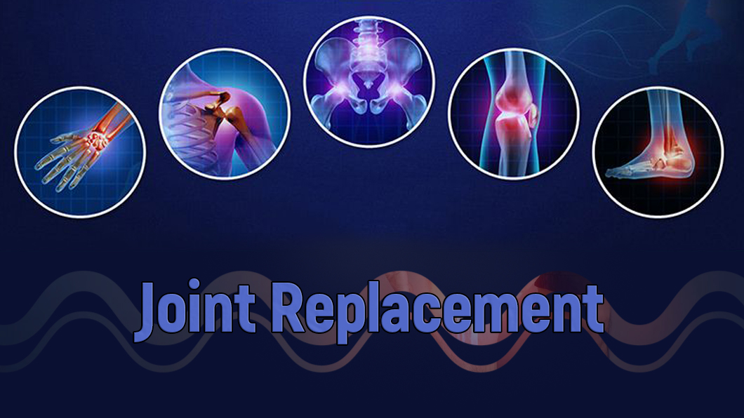 Joint replacement surgery specialist in chirmiri