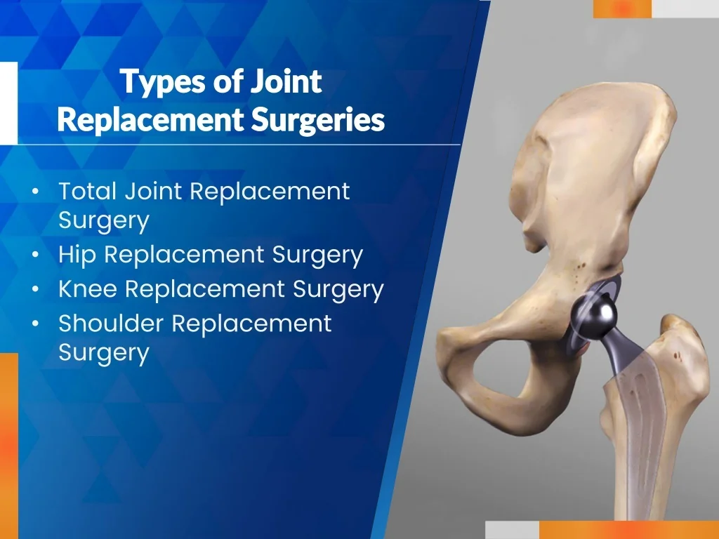 Joint replacement surgery specialist in jagdalpur