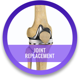 Joint replacement surgery specialist in raigarh