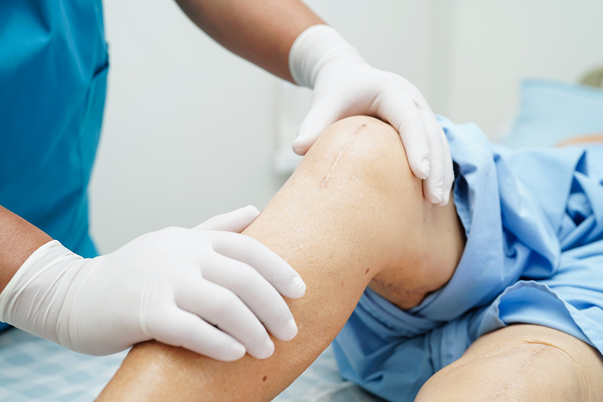 Knee replacement in chirmiri